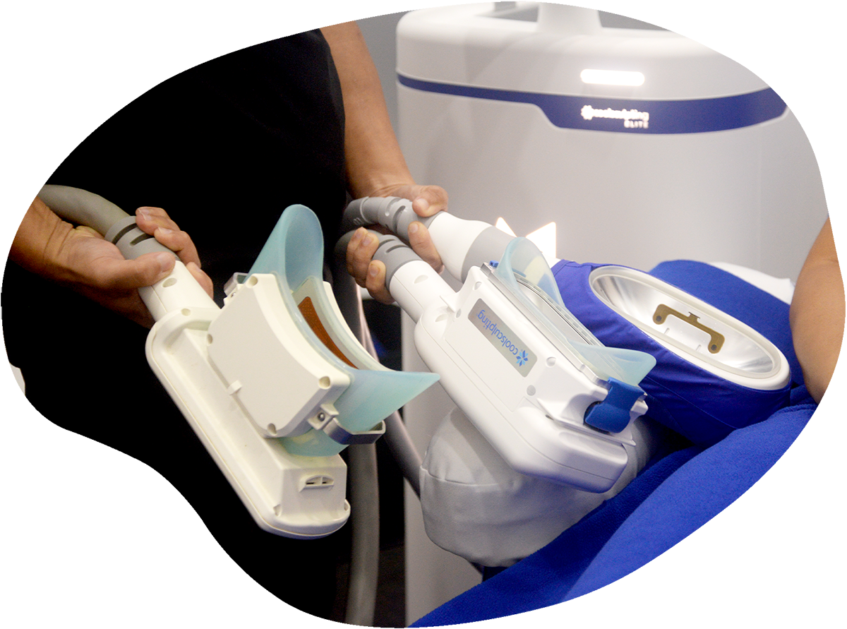 coolsculpting elite benefits improvements singapore