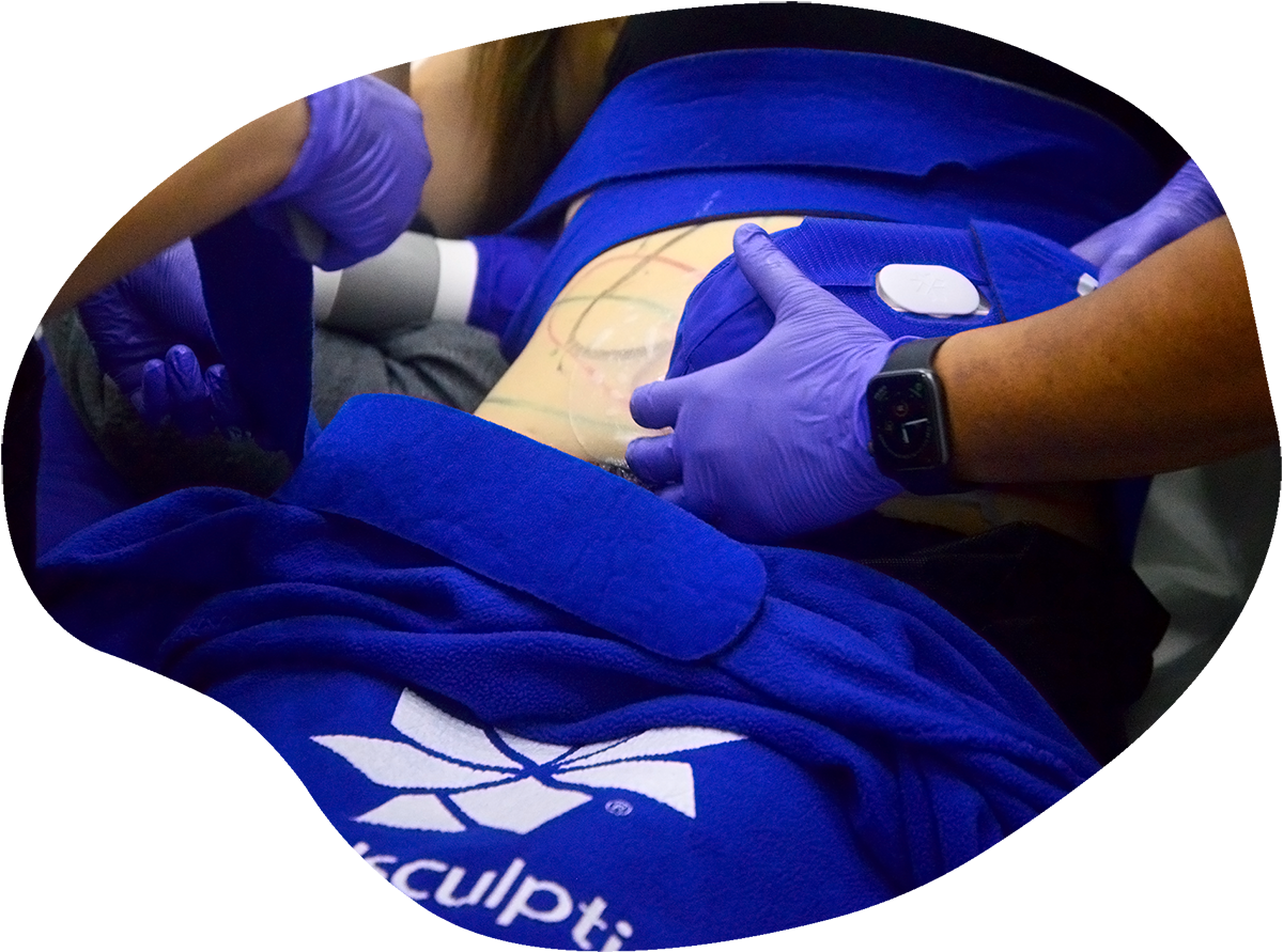 coolsculpting elite fat freezing clinic singapore